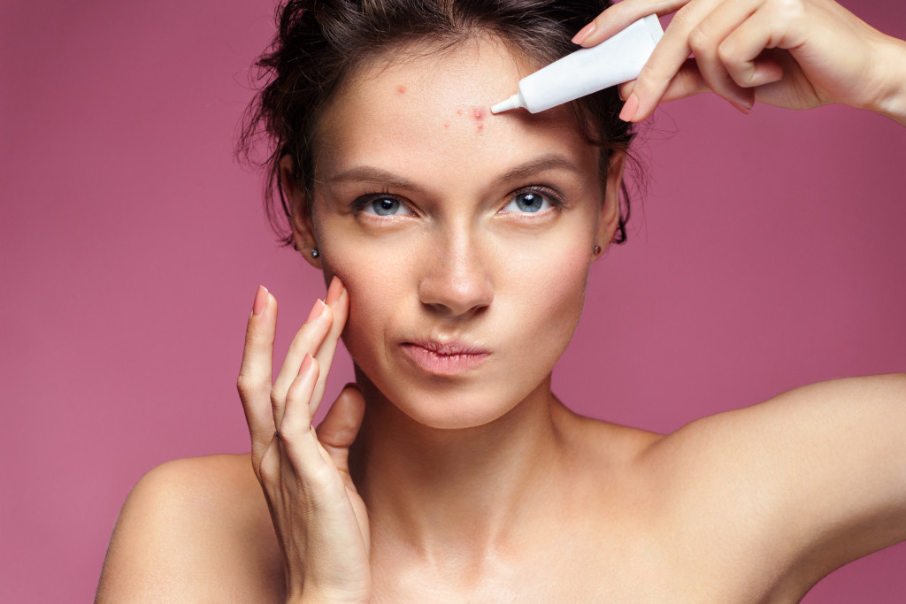 pointing at her acne and appling treatment cream